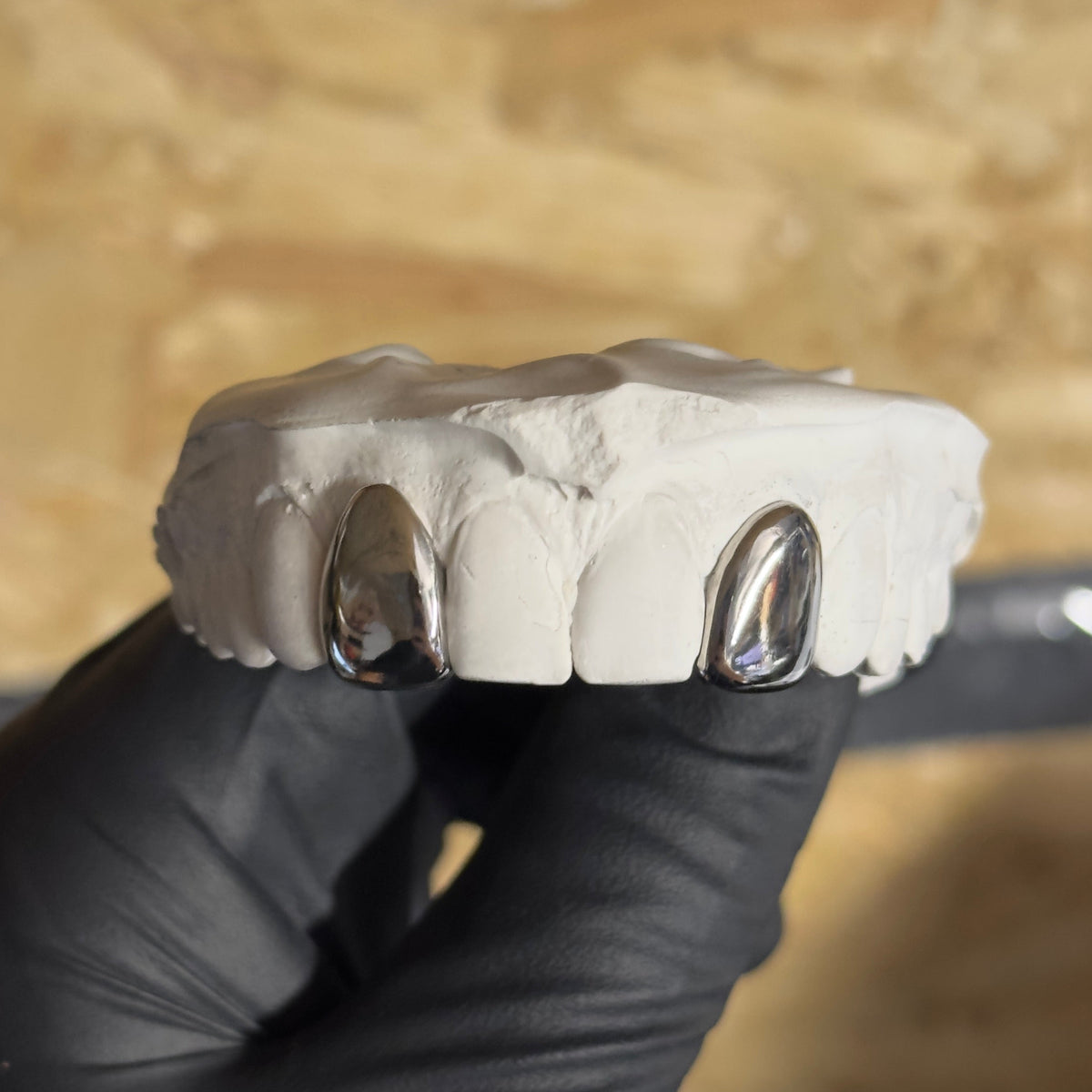 Picture of black glove holding 2 dental silver caps on a white stone model 