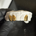 3 dental gold caps on a white stone model held by black gloves