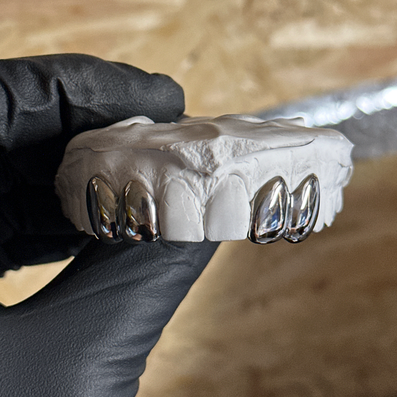 4 dental silver caps on stone model being held by black glove