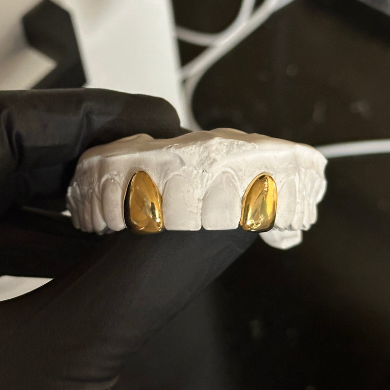 2 dental gold caps on a white stone mould being held by a black glove