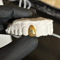 single dental gold cap on a white stone model held by a black glove