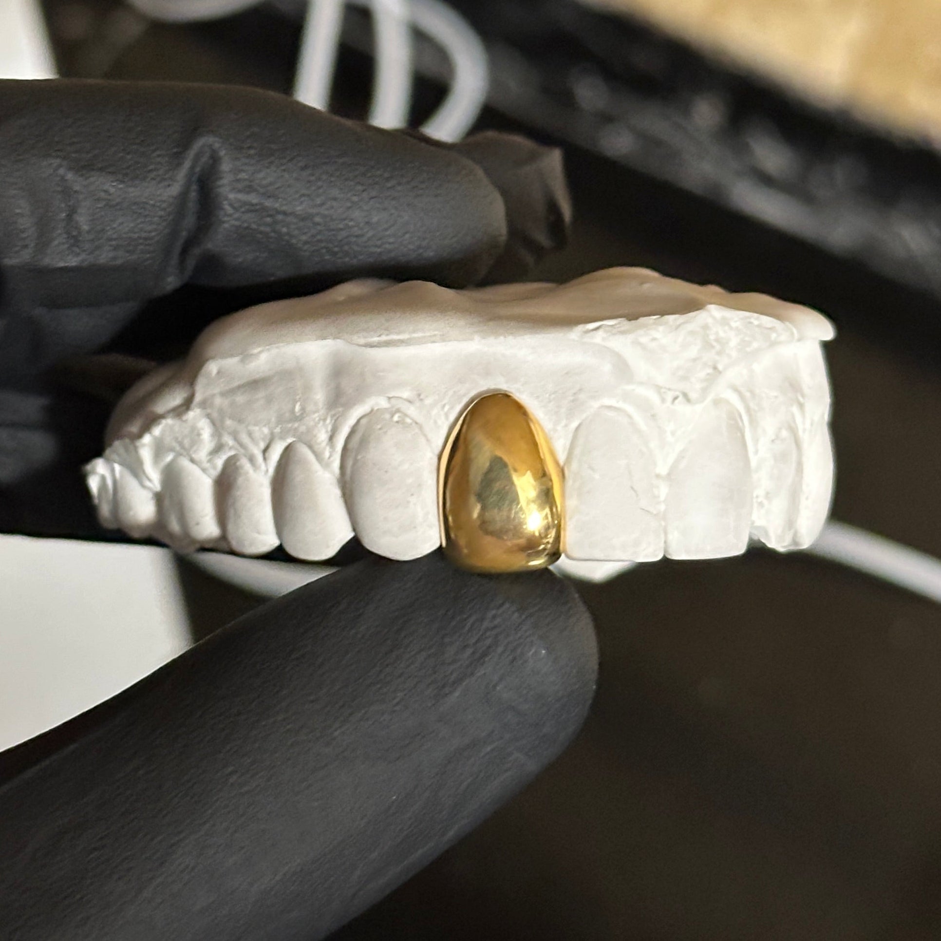 single dental gold cap on a white stone model held by a black glove