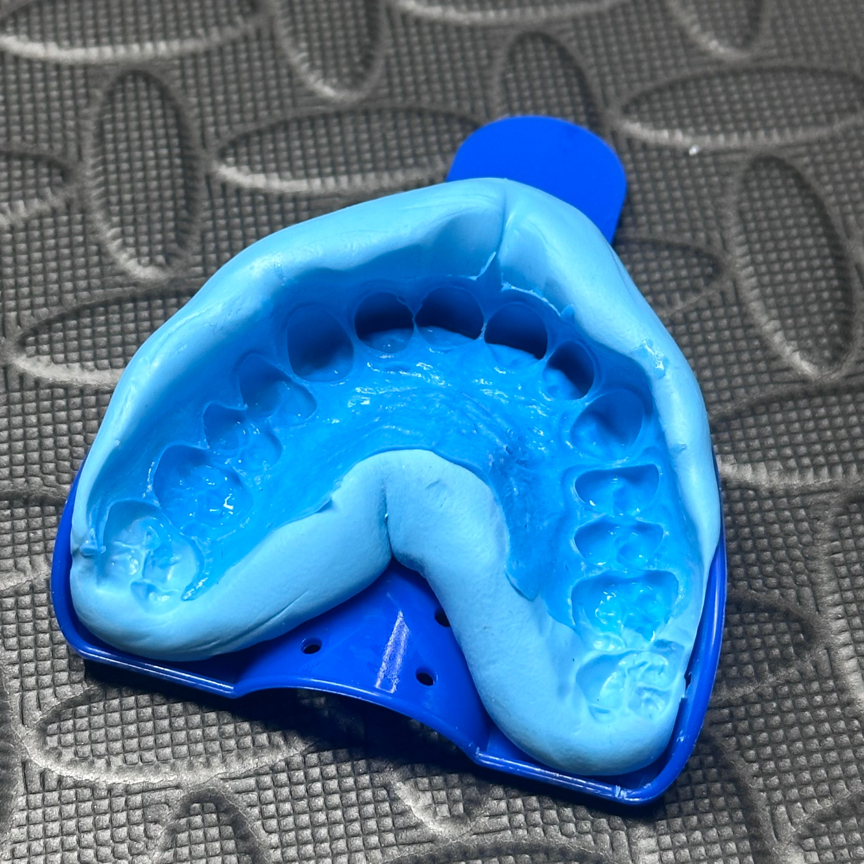 Onyx Grillz Impression Kit