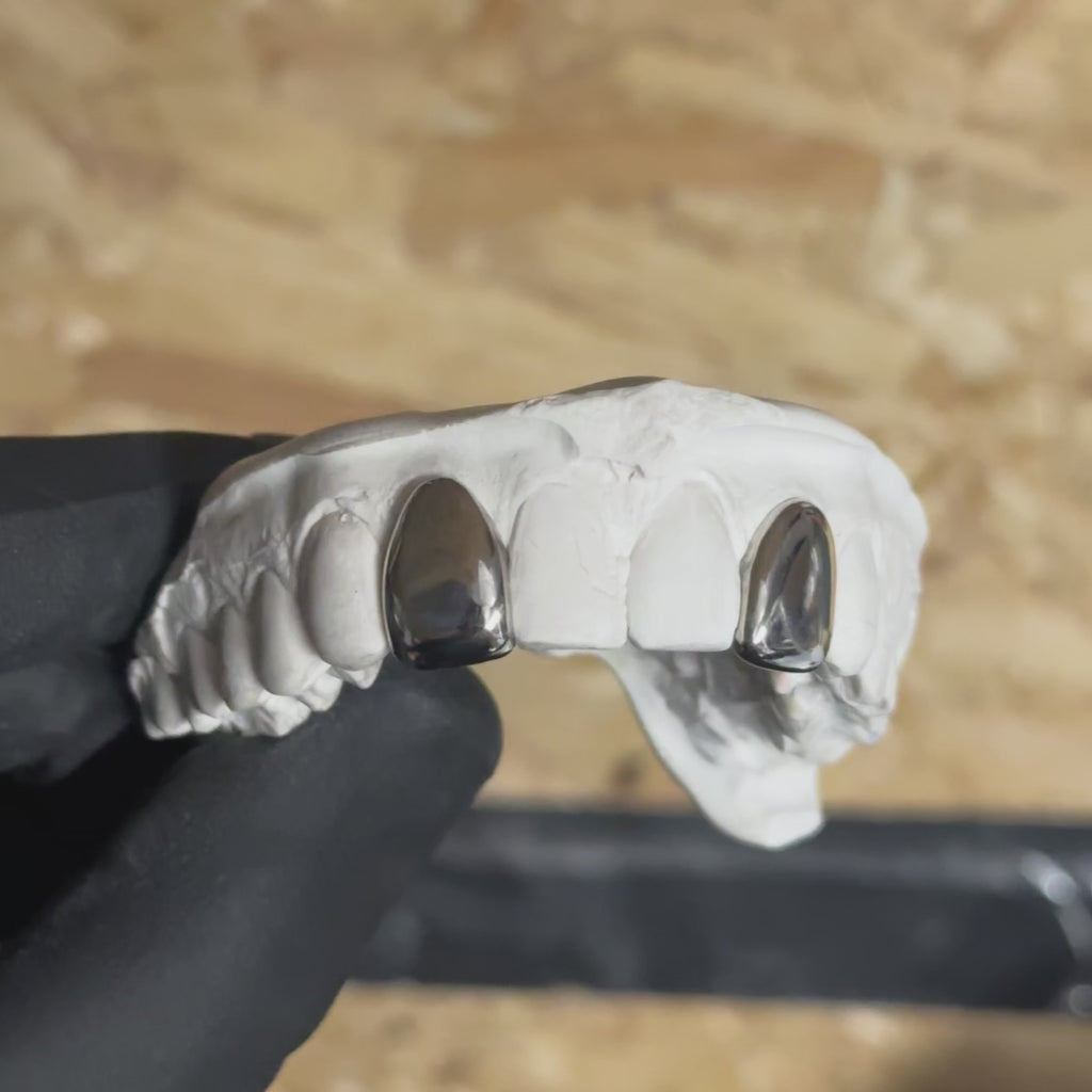 2 Teeth Custom Grillz UK | Dental Silver Caps | Onyx Grillz