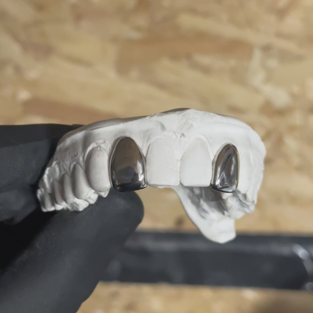 2 Teeth Custom Grillz UK | Dental Silver Caps | Onyx Grillz
