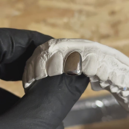Singe silver tooth cap being shown different angles by a black glove
