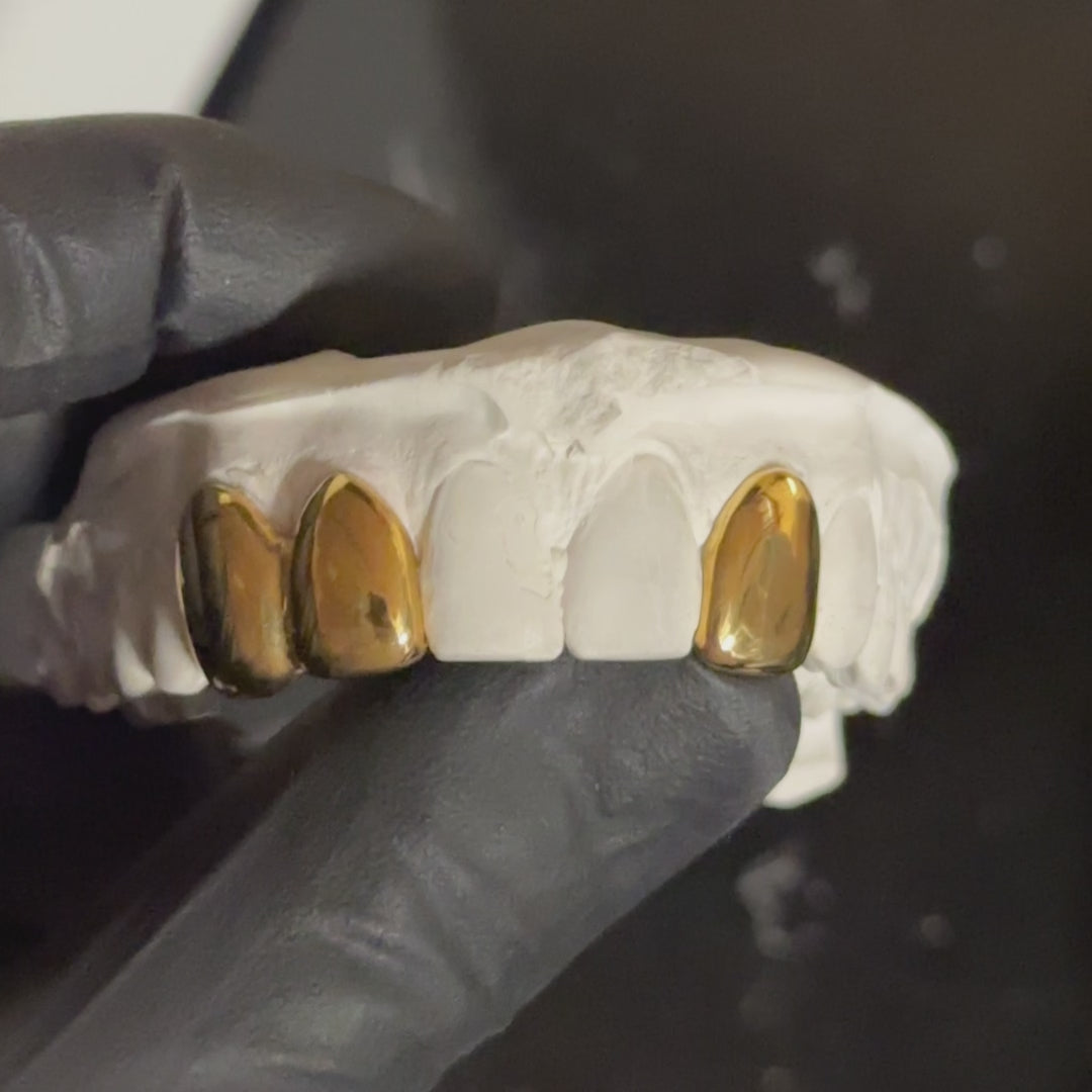 3 Teeth Custom Grillz UK | Dental Gold | Onyx Grillz