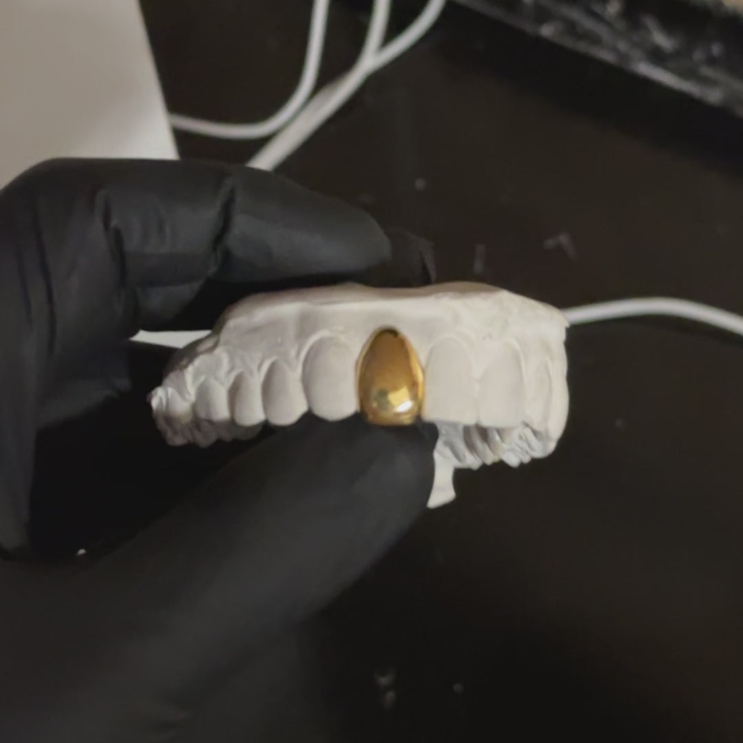 1 Tooth Custom Grillz UK | Dental Gold Cap | Onyx Grillz