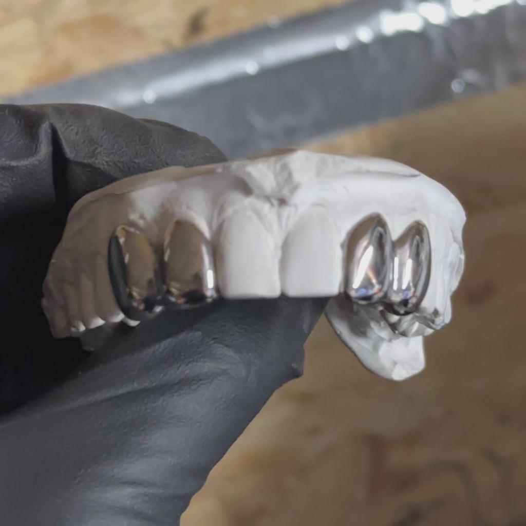 4 Teeth Custom Grillz UK | Dental Silver Caps | Onyx Grillz