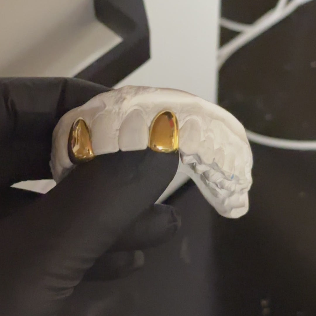 video of 2 dental gold caps on a white stone model 